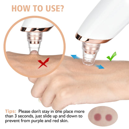 Electric Facial Skin Care Pore Removal Cleanser - Blackhead & Acne remover - BluePeak Ventures