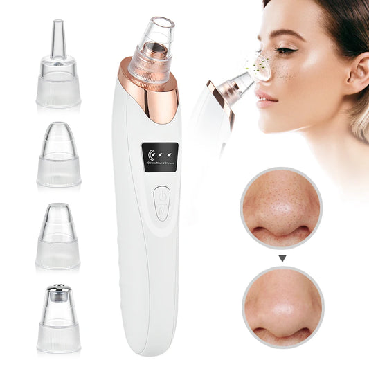 Electric Facial Skin Care Pore Removal Cleanser - Blackhead & Acne remover - BluePeak Ventures